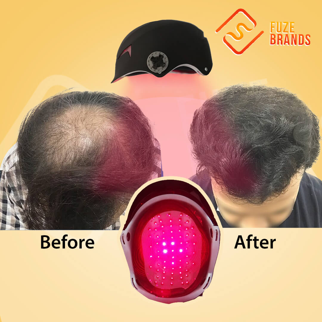 SCAP™ Laser Hair Growth Cap